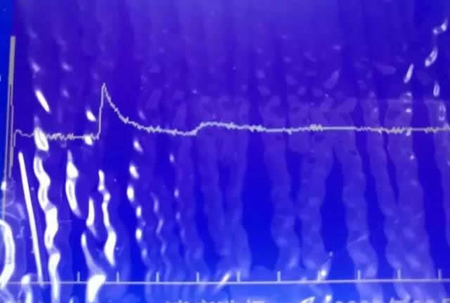 �h(yu��n)����ʾ�}�_�y(c��)ԇ����